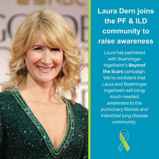 Diane Ladd, Legendary Actress Cause Of Death, Obituary: Beloved Mother Of Laura Dern, Celebrated Icon